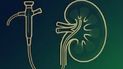 Ureteroscopy